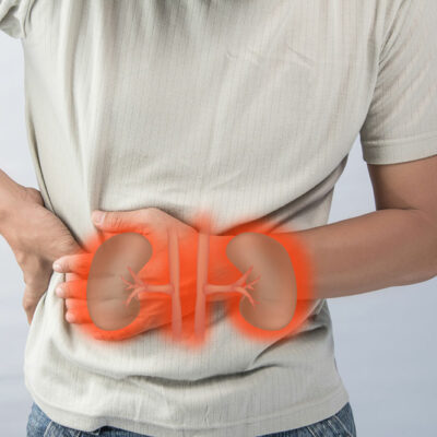 Lifestyle Tips to Prevent Renal Cancer