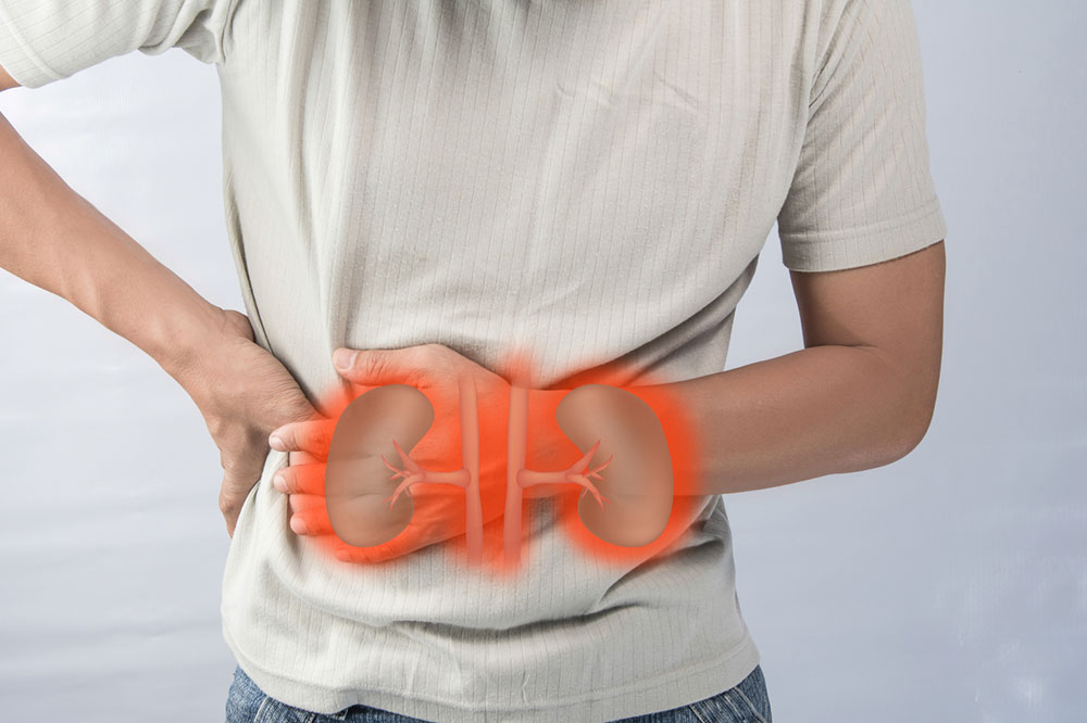 Lifestyle Tips to Prevent Renal Cancer