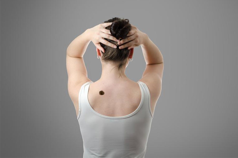 Tips to Prevent Skin Cancer