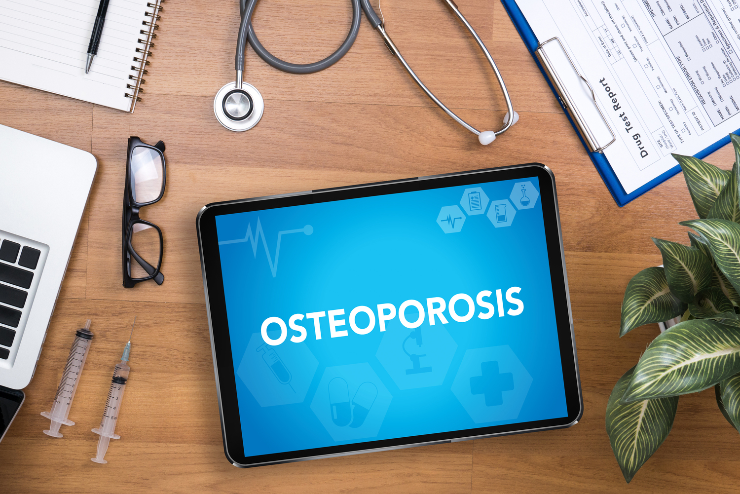 The Top 5 Osteoporosis Treatments