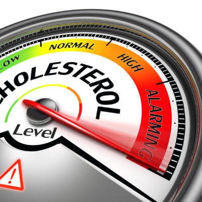 Prevention and Treatment of High Cholesterol