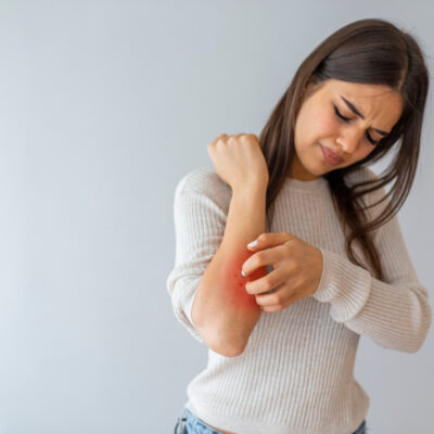 Treatment Medications and Foods to Avoid With Psoriasis