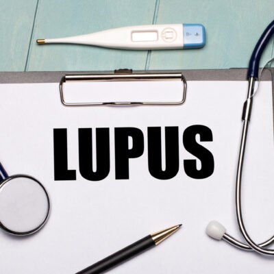 6 Warning Signs Of Lupus