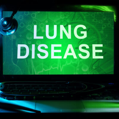 5 Foods to Avoid With Lung Disease